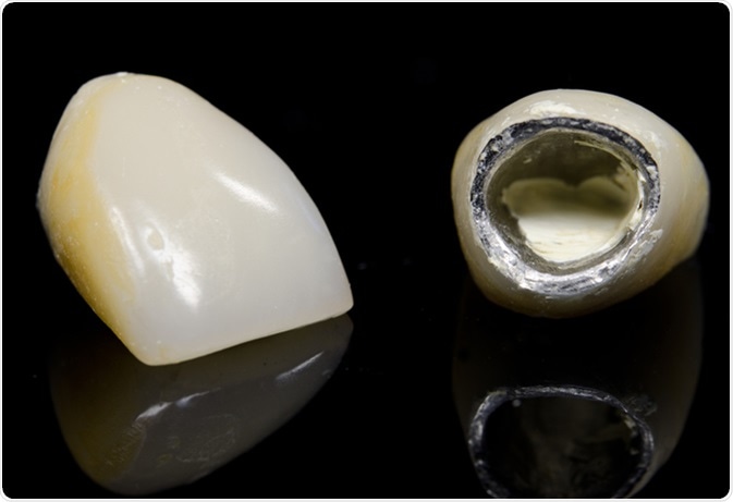 Old dental crowns. Image Credit: PHOTO FUN / Shutterstock